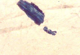 This blue banded plaque formed on the inside of a healing Band-Aid.  That is the flesh toned background in the photo. 200x
