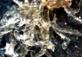 Morgellons Photo Journal - This is view 2 of photo #291 separated strands.  200x