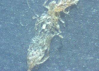 Morgellons Photo Journal - Here is the whole bundle of separated fibers from photo #291.  60x