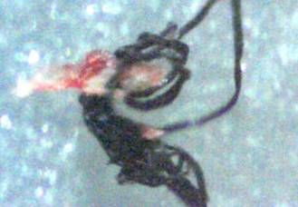 Morgellons Photo Journal - Here is a large dark strand with a designer flair.  200x