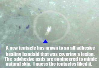 Morgellons Photo Journal - A tentacle attached itself to the inside of a healing Band-Aid.  Apparently it could not discriminate it from normal skin.  60x