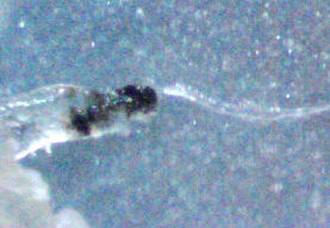 Morgellons Photo Journal - This is a  large oddly-shaped tentacle with a long tube growing from the end.  200x