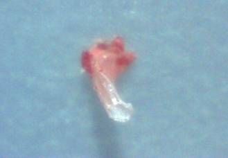 I found this hollow tube in my chin.  The one lesion I have on my chin has provided me with more strange debris then anywhere else on my body.  200x