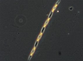 Pseudonitzschia phytoplankton 
